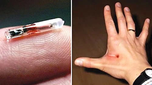 micropuce humaine
