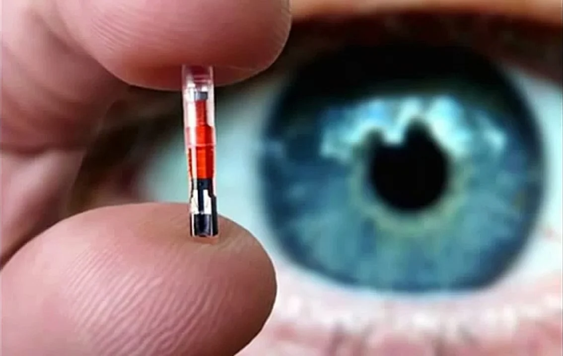 caractéristiques de la micropuce