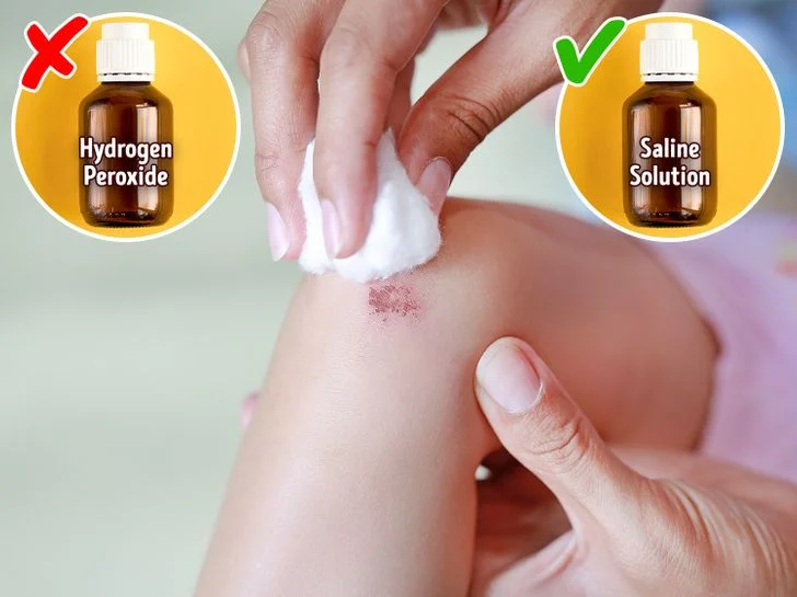 Utilisez une solution saline au lieu du peroxyde d'hydrogène pour rincer la plaie
