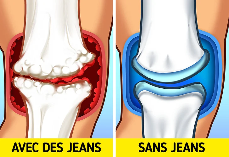 Vous risquez d'avoir mal aux genoux et aux pieds
