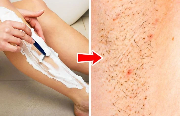 Vous serez moins exposé aux infections cutanées