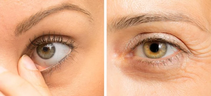 Vous vous frottez les yeux souvent