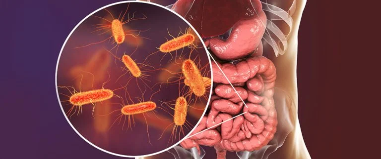 maladie de Crohn