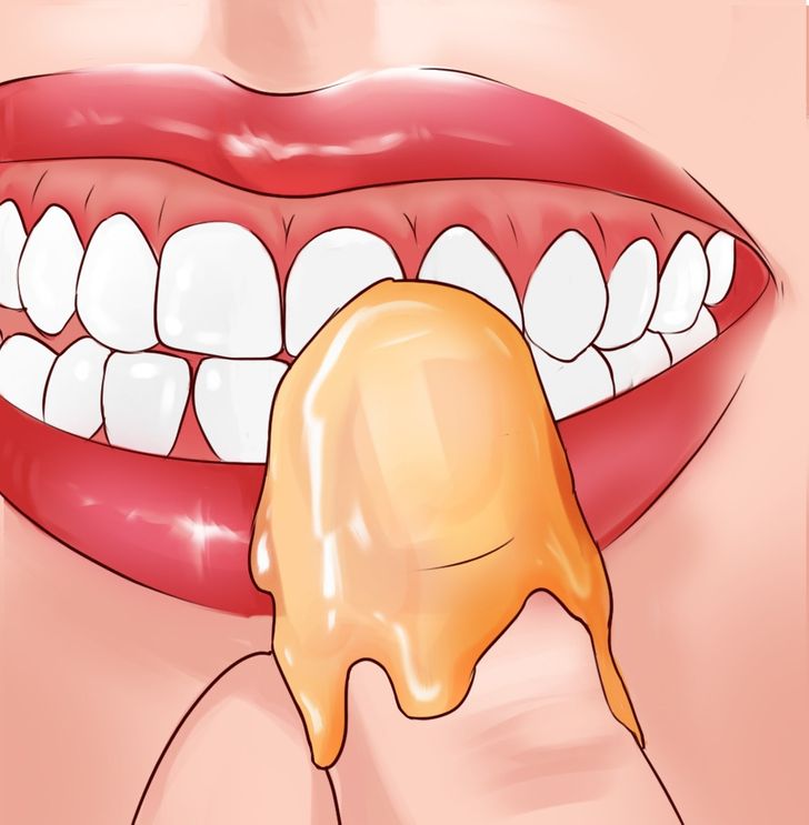 saignement miel bouche