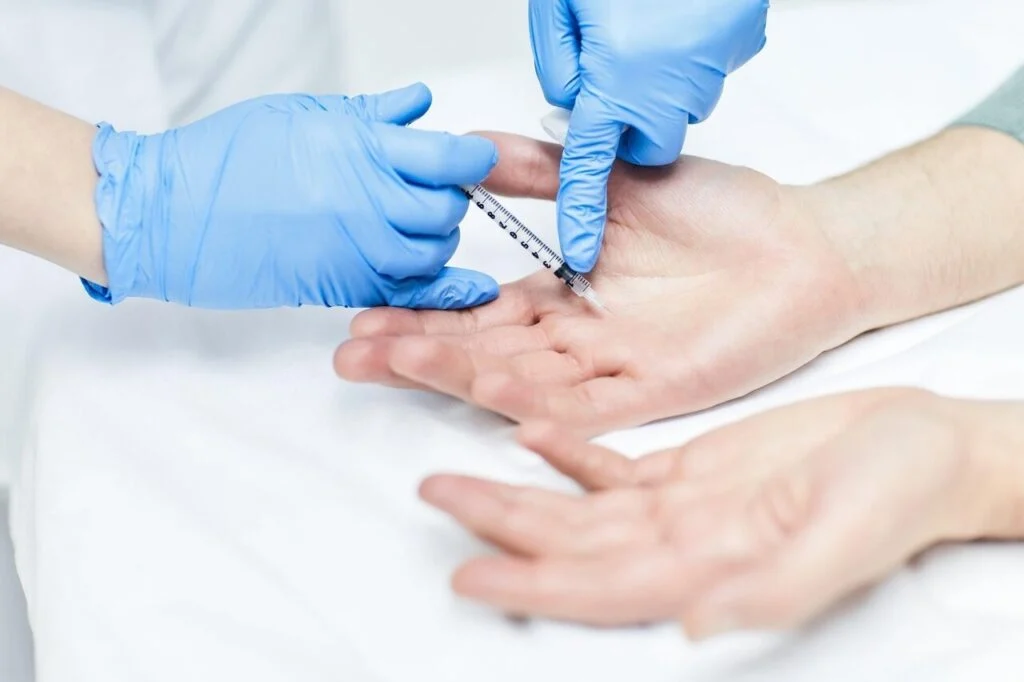 Botox mains
