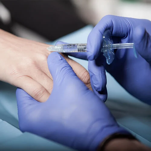 injections de graisse mains