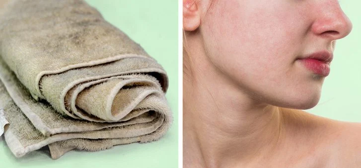 Cela risque d'irriter votre peau