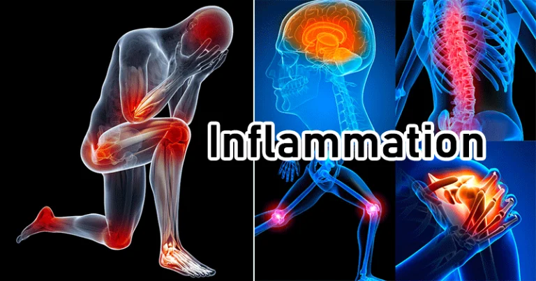 Un régime contenant des aliments anti-inflammatoires