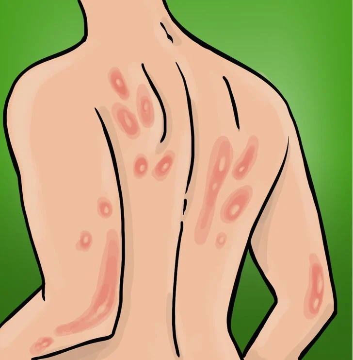 La peur peut provoquer des allergies et des dermatites