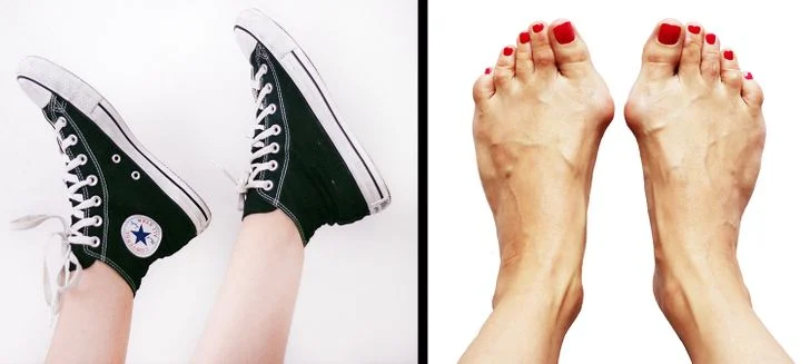 Les chaussures à semelles plates