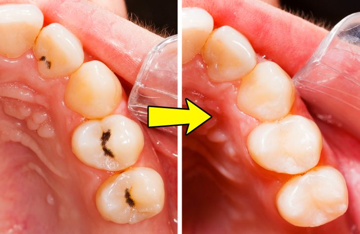 Vos dents seront plus saines