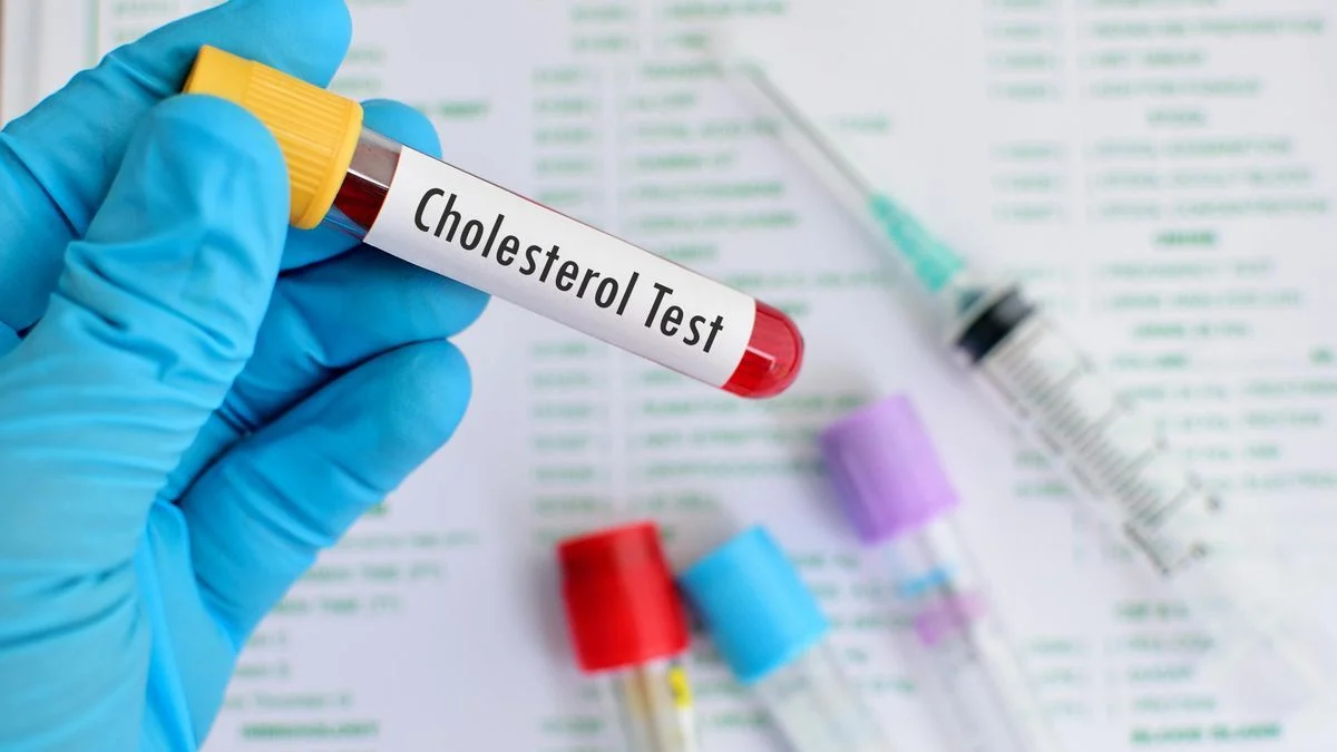 réduire le taux de cholestérol