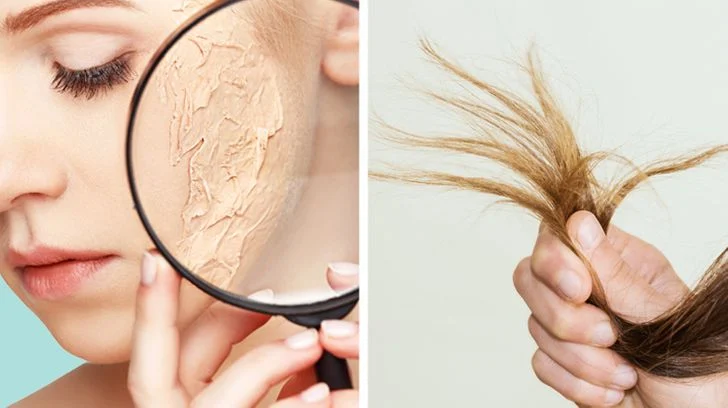 Des cheveux et une peau endommagés