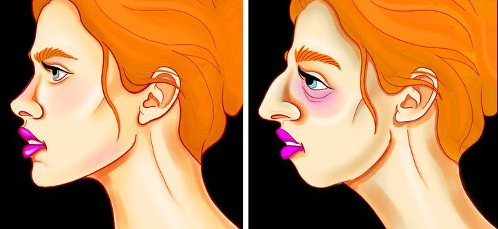 La forme de votre visage change