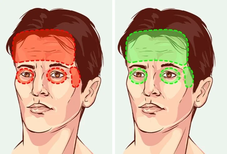 Vous pourriez ne plus avoir de maux de tête