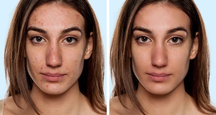 Votre peau pourrait devenir plus claire