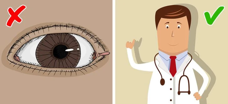 Consultez avant tout votre médecin acrochordons