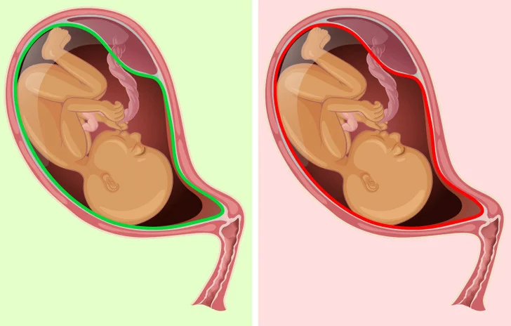 L'organisme de votre bébé n'est pas capable de décomposer la caféine contenue dans le déca
