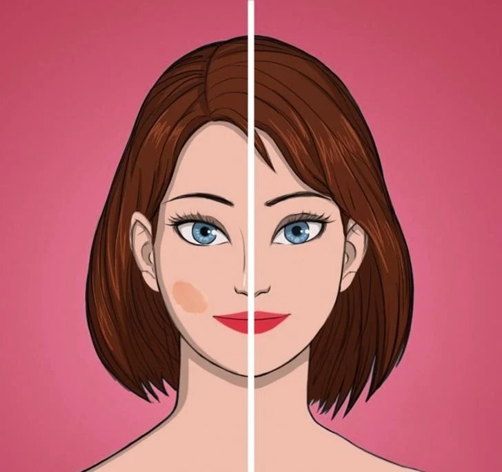 Éviter la pigmentation de la peau