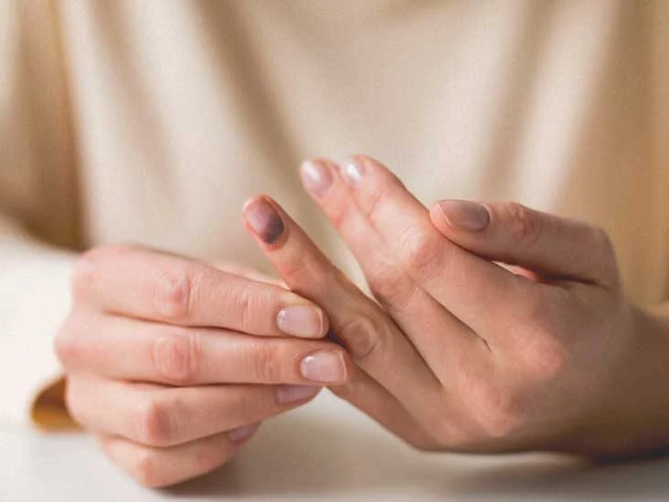 Les points de pression de la main et des doigts sont-ils efficaces ?