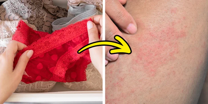 7 choses qui arriveront si vous portez des sous-vêtements toute la journée Vous pourriez ressentir une irritation de la peau