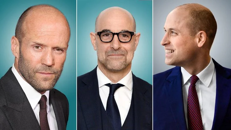 les hommes chauves sont plus attirants et plus intelligents