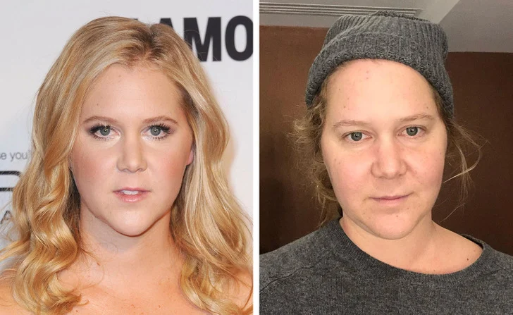 Amy Schumer