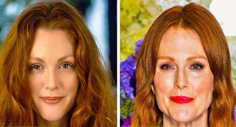 chirurgie esthétique