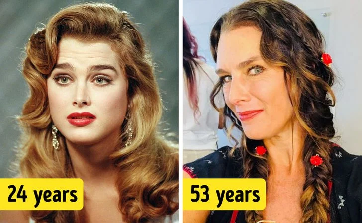 Brooke Shields chirurgie esthétique