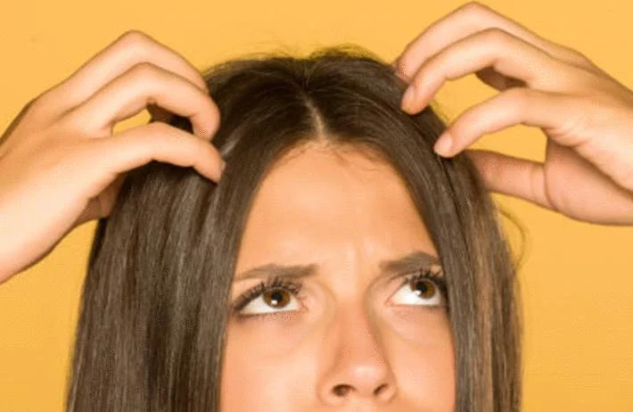 certaines causes de l'acné et des boutons du cuir chevelu