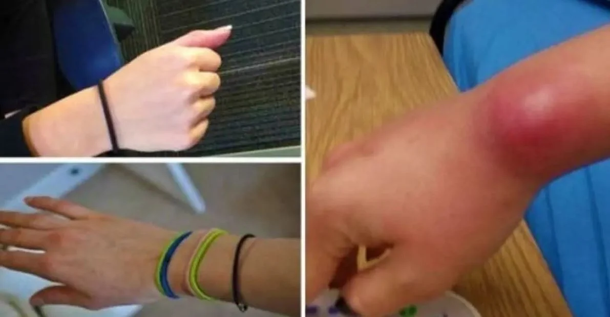4 raisons pour lesquelles vous ne devriez pas mettre votre élastique à cheveux autour du poignet vous ne devriez pas mettre votre élastique à cheveux autour du poignet