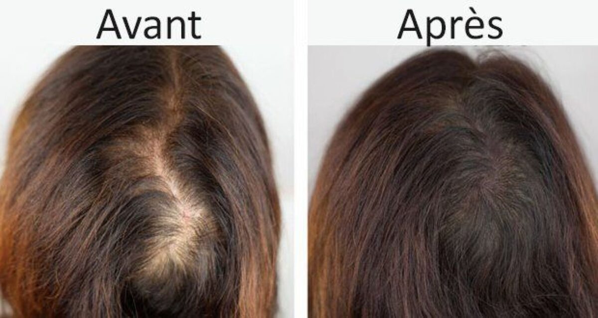 6 bienfaits des graines de fenugrec pour les cheveux et 2 façons de les utiliser ÊTRE HEUREUX