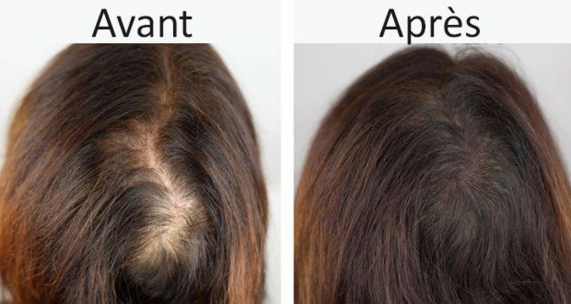 Réduit la perte de cheveux 