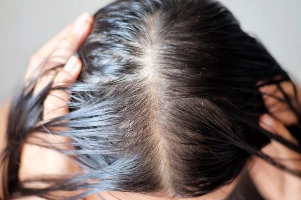 Fortifie les cheveux 