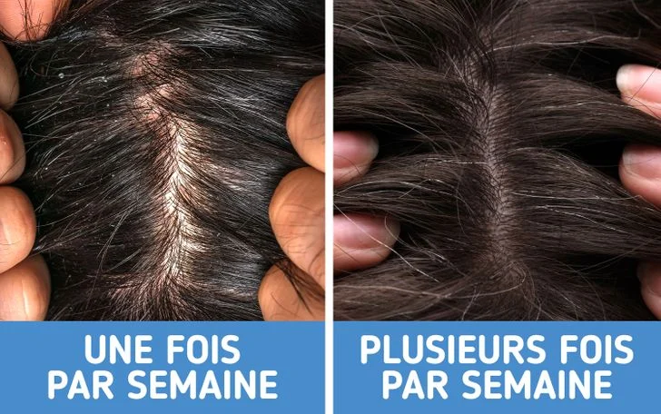 Avoir les cheveux sales