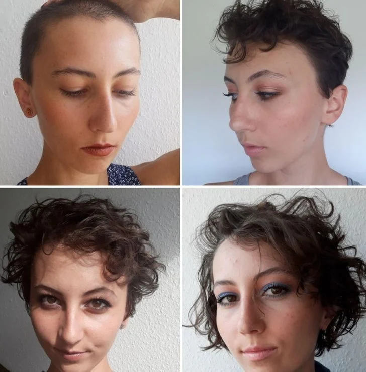 Il n'y a aucune raison de ne pas essayer, les cheveux finissent toujours par repousser