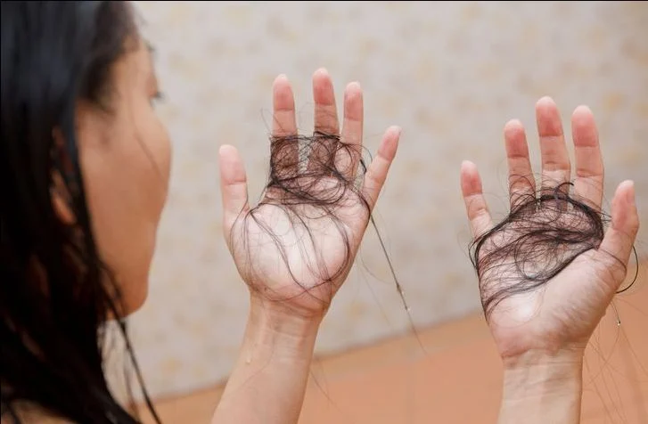 Tirez dessus perte de cheveux
