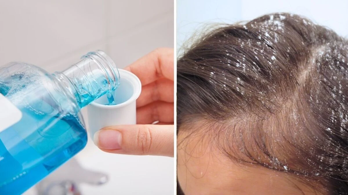 cheveux bain de bouche