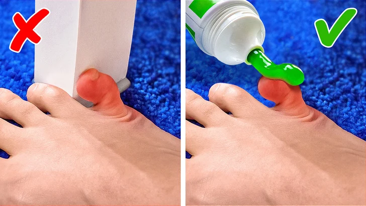 Le dentifrice pour réduire le gonflement