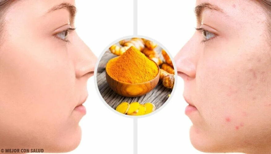 #2. Curcuma aliment