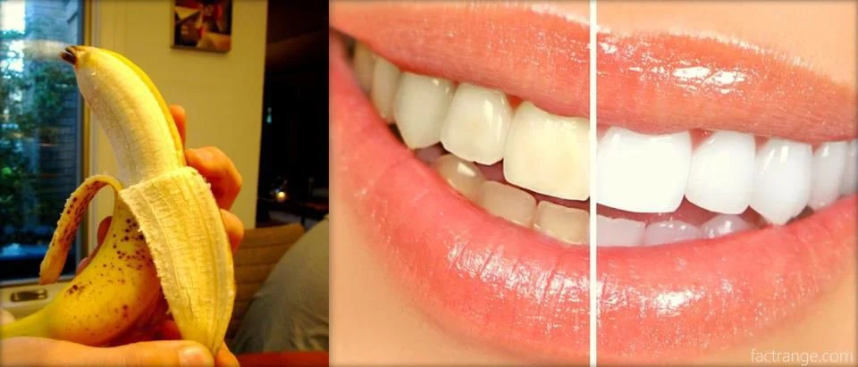 La peau de banane blanchit-elle les dents