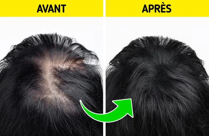 Favorisez la repousse de vos cheveux en intégrant le thé vert à votre régime alimentaire quotidien