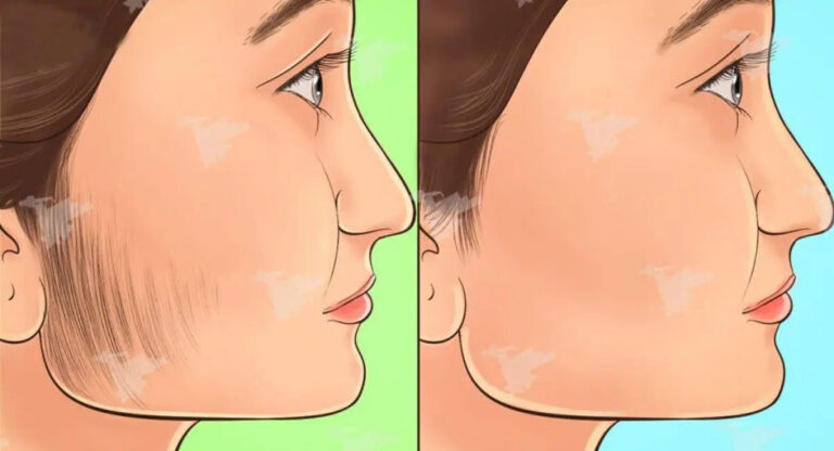 Poils du visage remèdes
