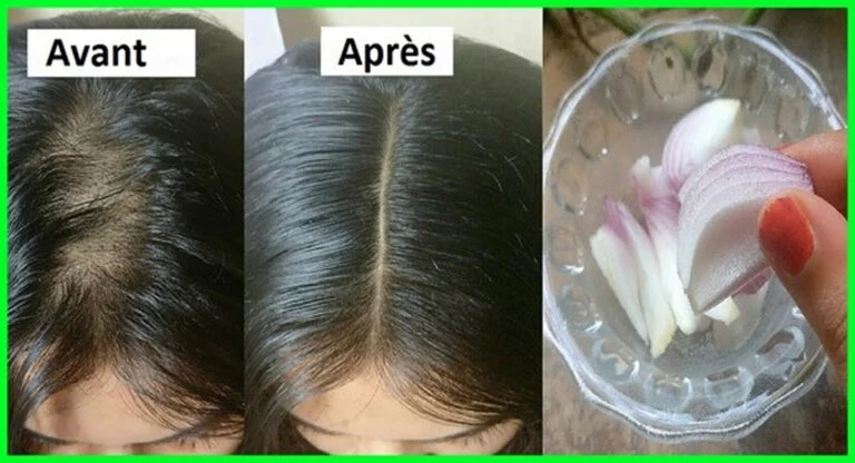 la pousse des cheveux