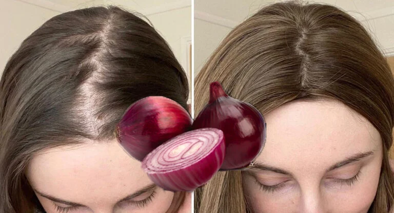 le jus d'oignon pour les cheveux