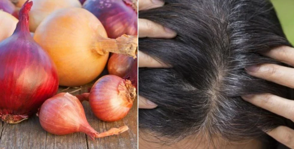 Voici toutes les raisons pour lesquelles le jus d'oignon aide si efficacement à faire pousser les cheveux