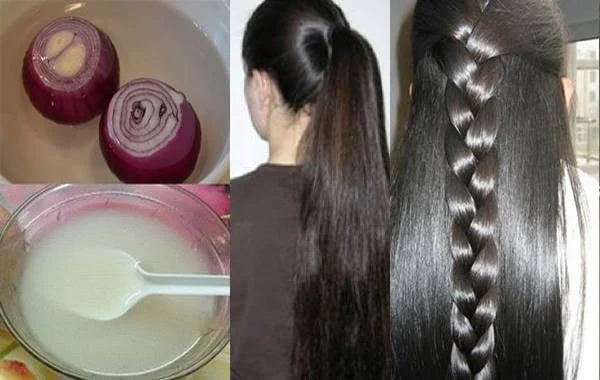 le jus d'oignon pour les cheveux