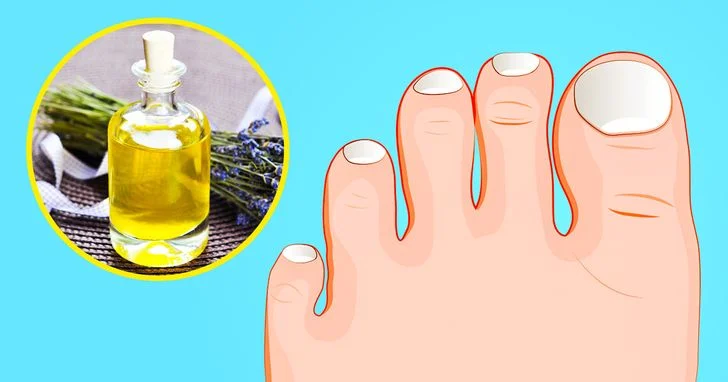 Préservez la beauté de vos pieds et la santé de vos ongles