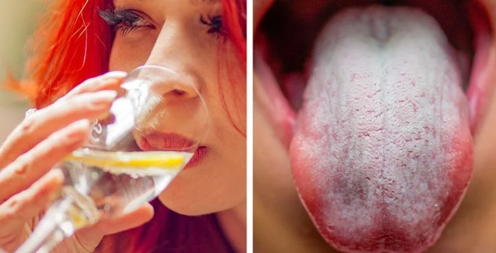 rendre votre bouche sèche