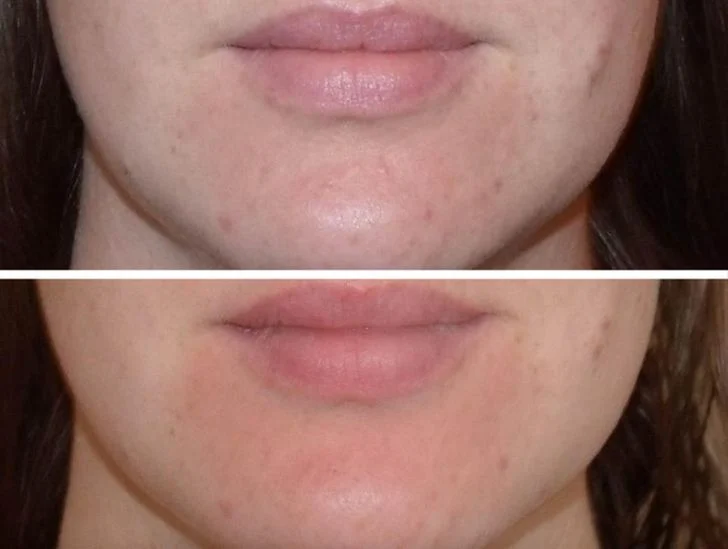 Favoriser le rétablissement de la peau